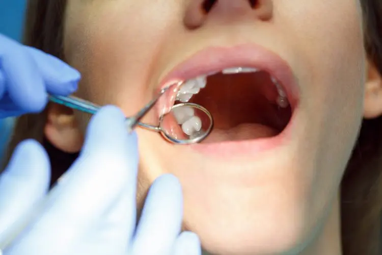woman getting a dental treatment norburn dental burnaby dentist